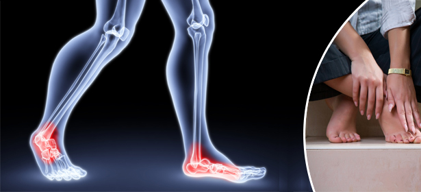 Бурсит большого пальца на ноге: симптомы и лечение суставов стопы